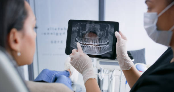 Licensed Teeth Whitening service in Bristol city County, VA - Smile Center Dentistry